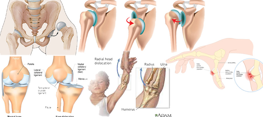 ویزیت و درمان در رفتگی