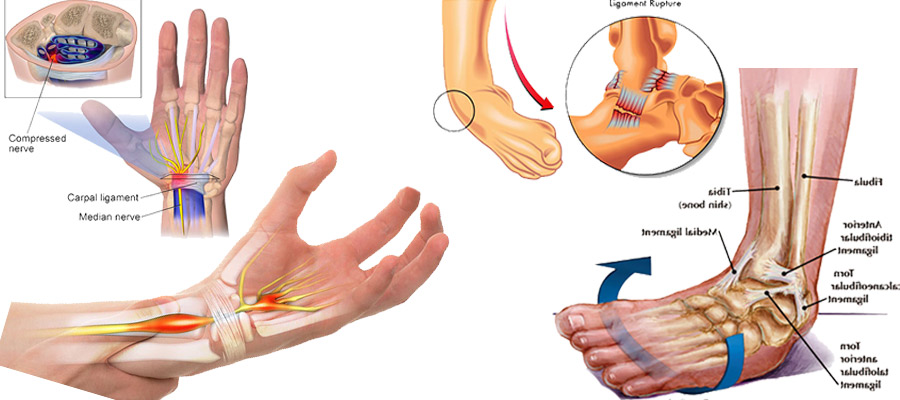 ویزیت و درمان در رفتگی و پیچ خوردگی